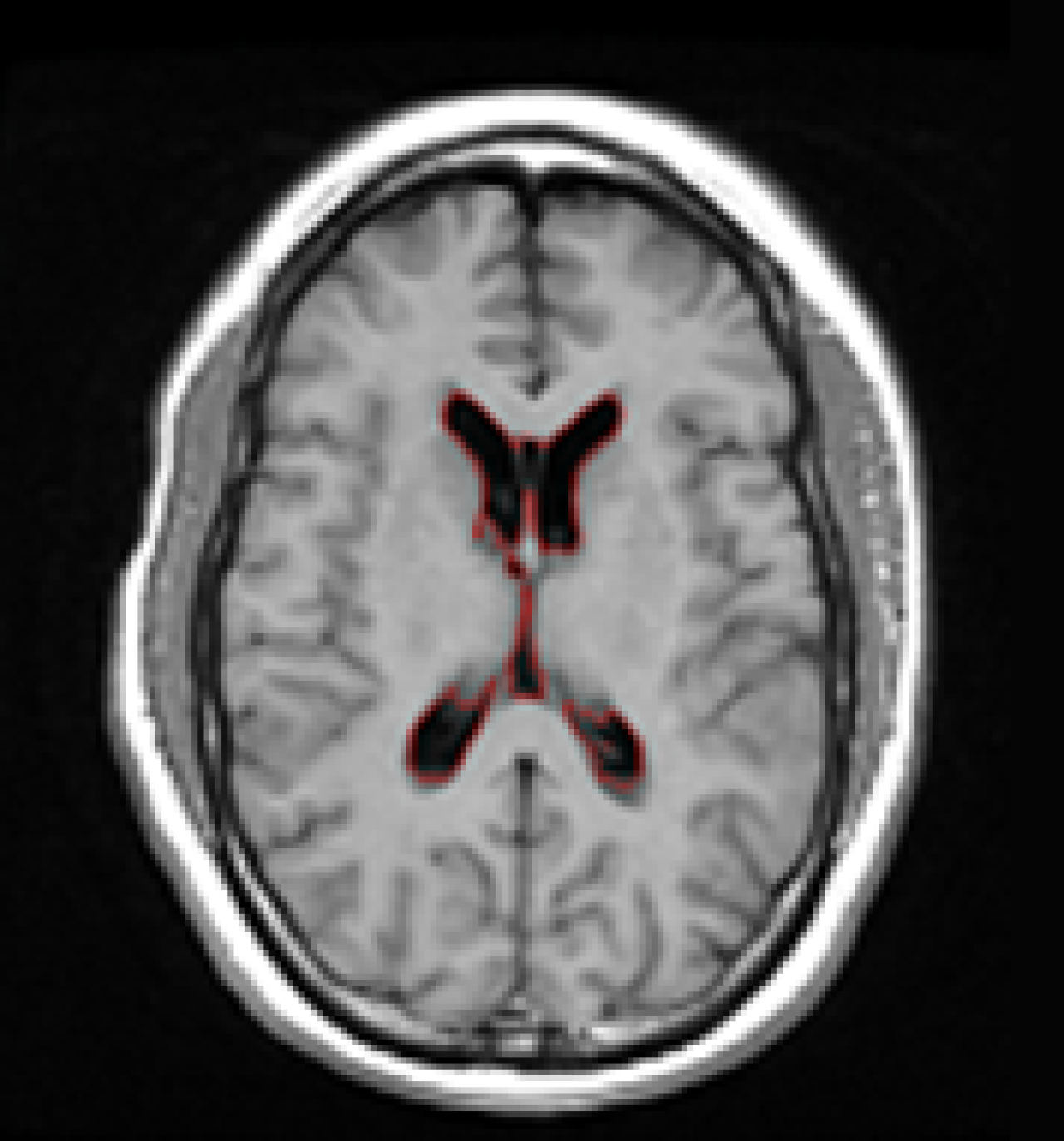 Brain-related Applications | Columbia Department of Radiology
