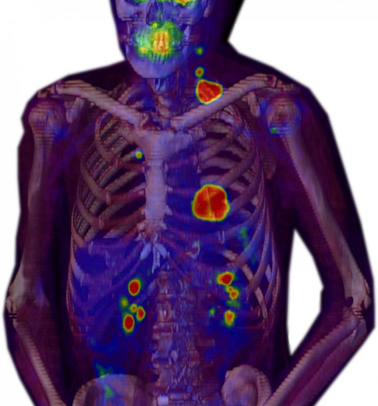 Division of Nuclear Medicine | Columbia Radiology | Columbia Department