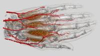3D rendering of a hand skeleton