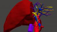 3D image of a liver