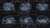 MRI image with superimposed equations
