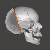 3D image of a skull