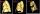 Volumetric measurement of mesothelioma