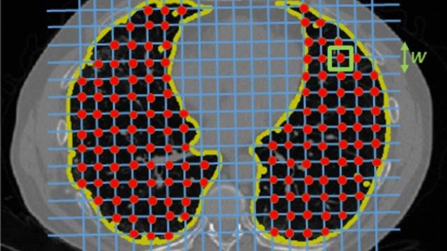 Computational Biomarker Imaging Group (CBIG) | Columbia Department of ...